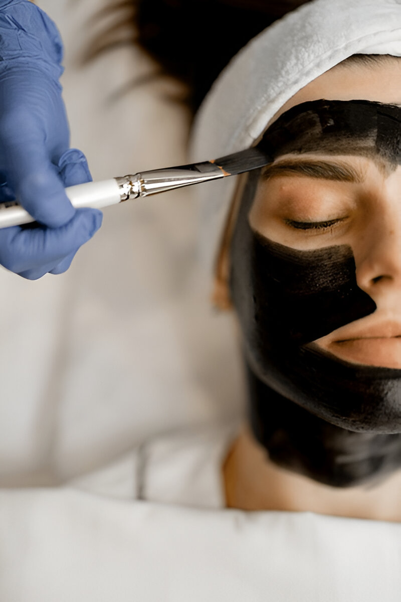 CARBONPEEL CARBON PEEL