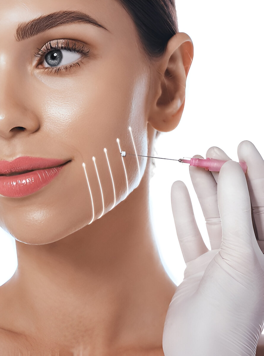 ThreadLift ThreadLift