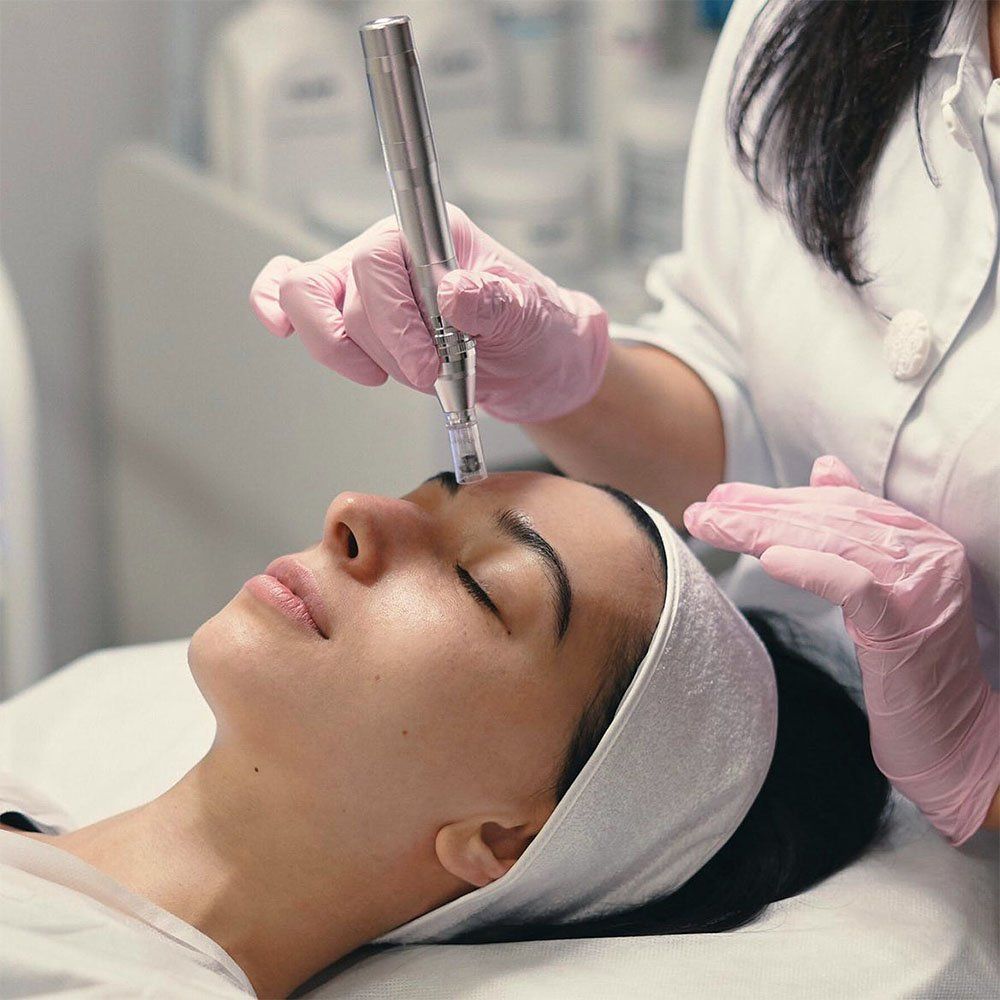microneedling.