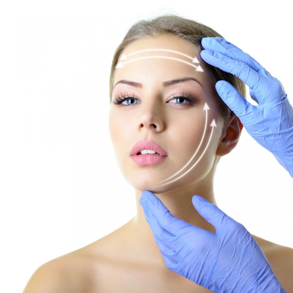 threadlift