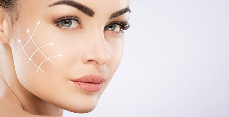 threadlift